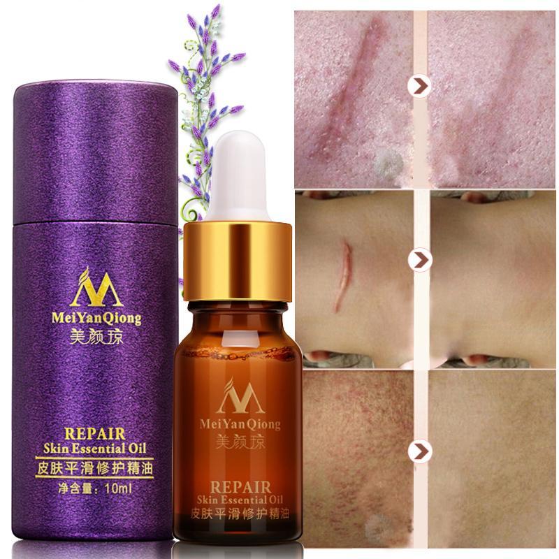 Scar Repair Skin Essential Oil
